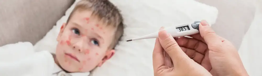 Boy with chickenpox mom, checking his temperature