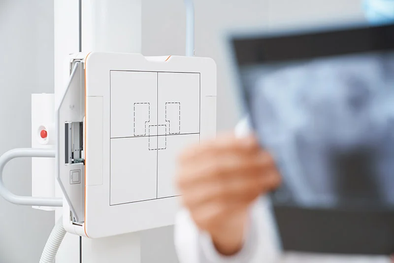 Mammogram machine